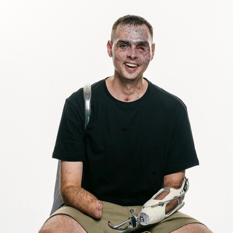 Images by photographer Giles Duley.