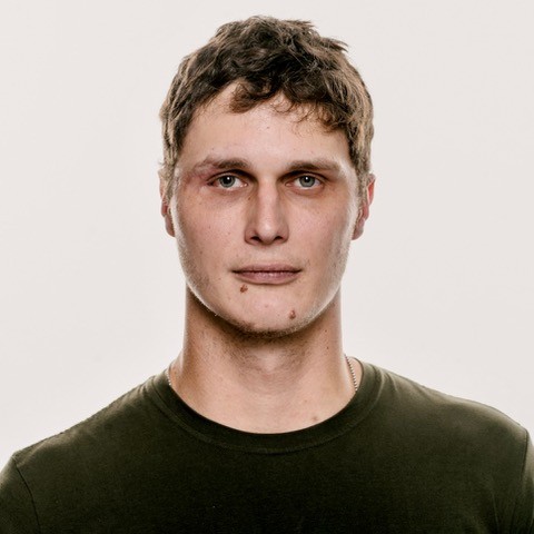 Images by photographer Giles Duley.