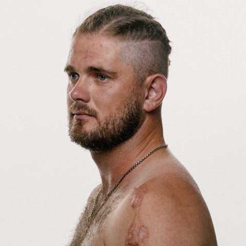 Images by photographer Giles Duley.